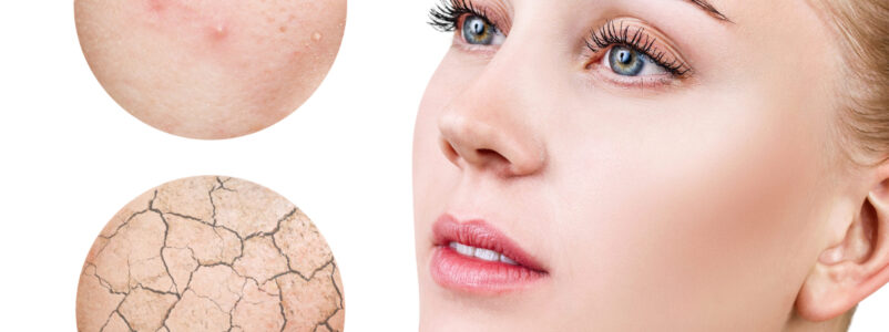 Dermatologia